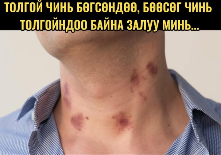 Толгой чинь бөгсөндөө, бөгс чинь толгойндоо байна залуу минь...